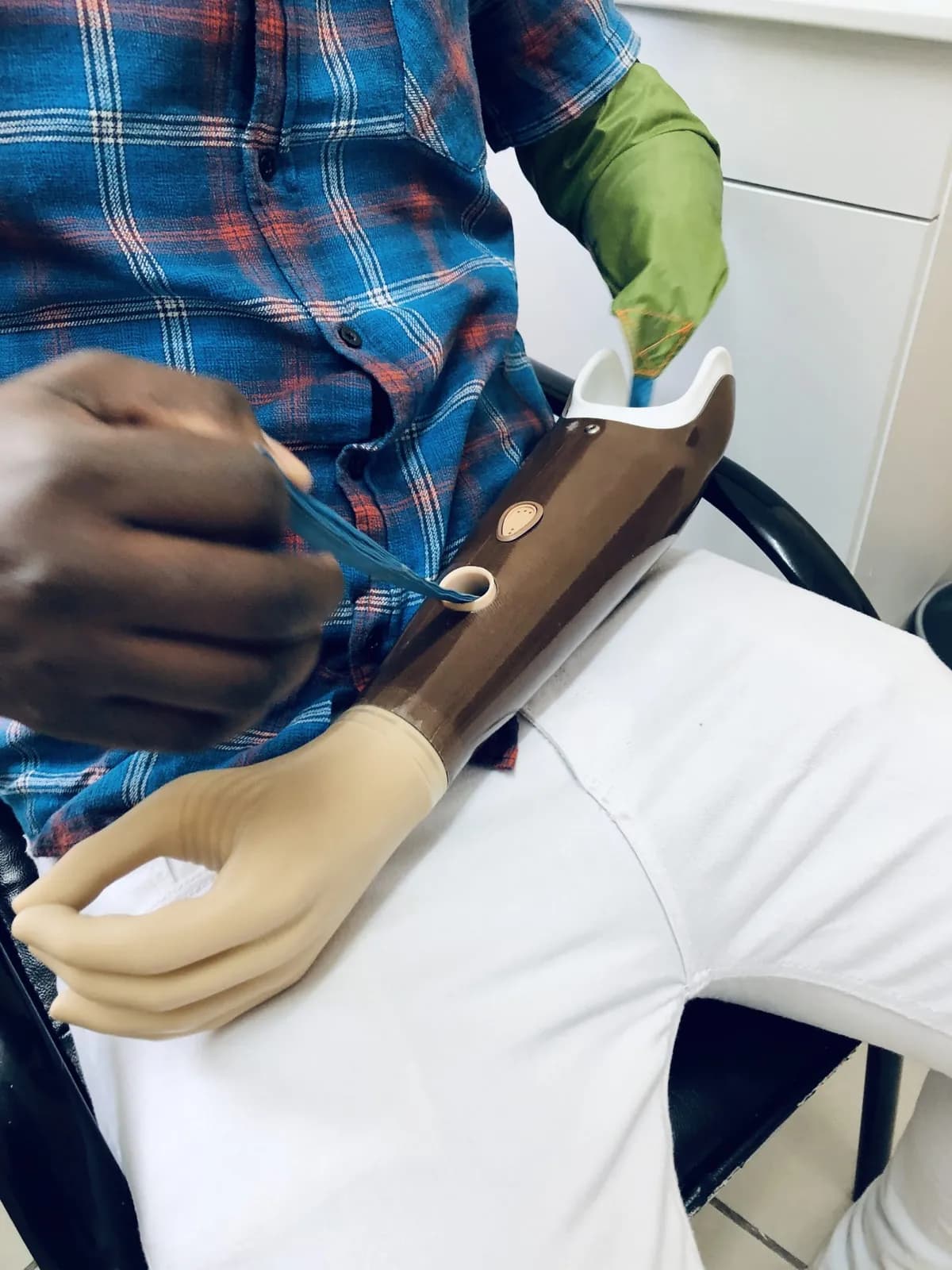 An upper limb prosthesis